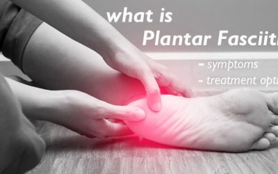 WHAT IS PLANTAR FASCIITIS?