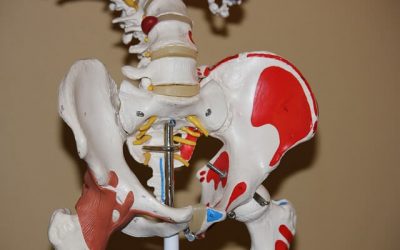 Lateral Hip Pain: Greater Trochanteric Pain Syndrome